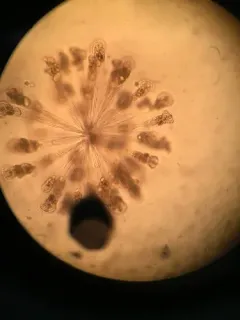 Conochilus hippocrepis thumbnail 2