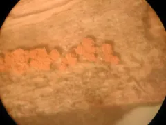 Hemitrichia abietina thumbnail 2