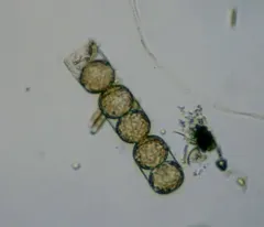 Melosira inflexa thumbnail 3
