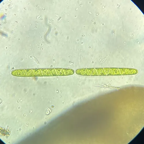 Spirotaenia condensata