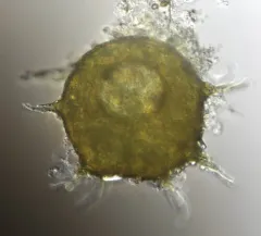 Centropyxis aculeata thumbnail 4