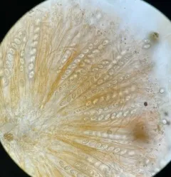 Scutellinia nigrohirtula thumbnail 1