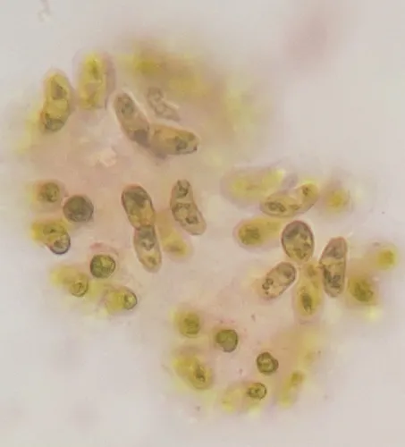Dimorphococcus lunatus