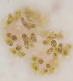 Dimorphococcus lunatus thumbnail 1
