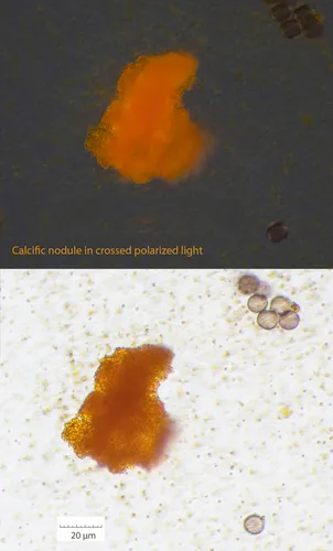 Physarum lateritium