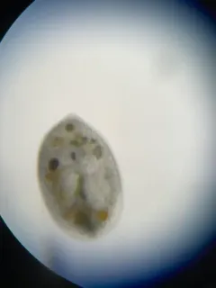 Frontonia acuminata thumbnail 4