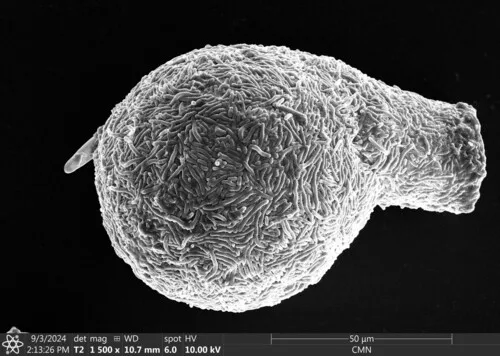 Lesquereusia spiralis