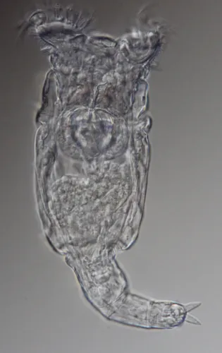 Philodina megalotrocha