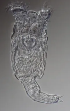 Philodina megalotrocha thumbnail 1