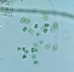 Cosmocladium constrictum thumbnail 1