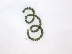 Dolichospermum crassum thumbnail 1