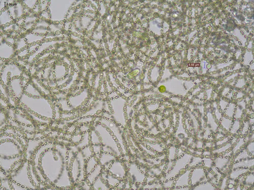 Dolichospermum mendotae