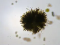 Gloeotrichia echinulata thumbnail 3