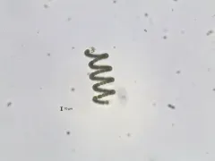 Dolichospermum crassum thumbnail 3