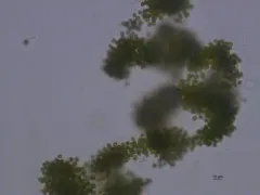 Microcystis aeruginosa thumbnail 2