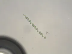 Arthrospira jenneri thumbnail 3