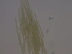 Aphanizomenon flosaquae thumbnail 3
