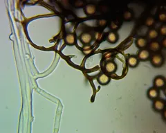 Stemonitis mussooriensis thumbnail 1