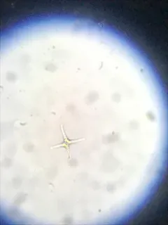 Staurastrum tetracerum thumbnail 3