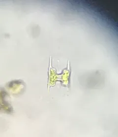 Staurodesmus extensus thumbnail 4