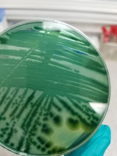 Vibrio parahaemolyticus