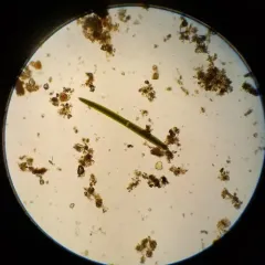 Closterium acerosum thumbnail 3