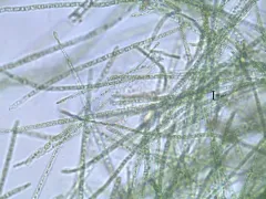 Planktothrix agardhii thumbnail 2
