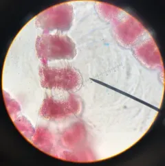 Campylaephora gardneri thumbnail 1