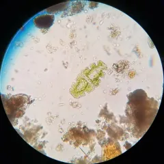 Euastrum oblongum thumbnail 3