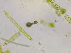 Microcystis wesenbergii thumbnail 1