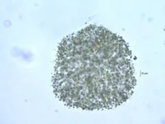 Microcystis flos-aquae thumbnail 3