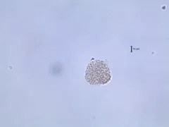 Aphanocapsa incerta thumbnail 2