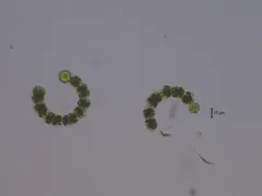 Dolichospermum crassum thumbnail 4