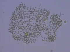Microcystis smithii thumbnail 4