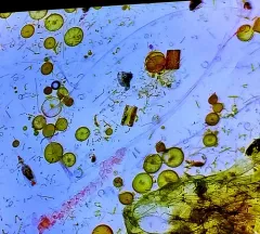 Muggiaea atlantica thumbnail 2