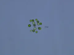 Sphaerocystis schroeteri thumbnail 3