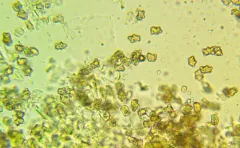 Inocybe praetervisa thumbnail 3