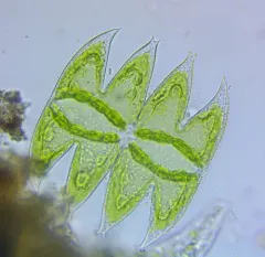 Micrasterias laticeps thumbnail 2