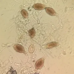 Ampelomyces quisqualis thumbnail 1