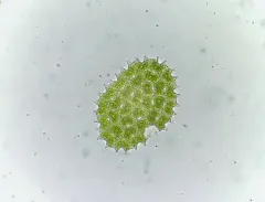 Pediastrum angulosum thumbnail 4