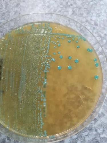 Listeria monocytogenes