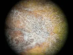 Podosphaera macrospora thumbnail 1