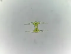 Staurastrum leptocladum thumbnail 1