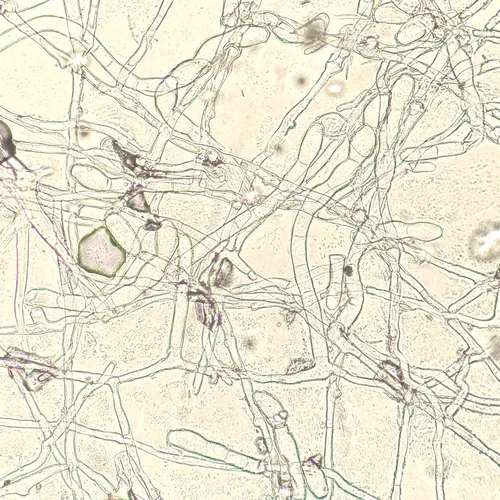 Golovinomyces hieraciorum