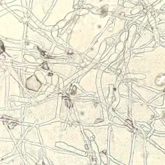 Golovinomyces hieraciorum thumbnail 1