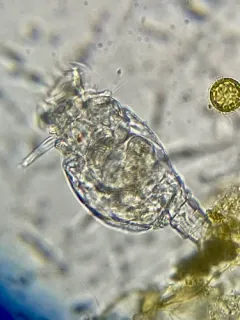 Philodina megalotrocha thumbnail 2