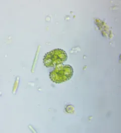 Cosmarium porteanum thumbnail 3