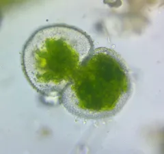 Cosmarium dentatum thumbnail 2