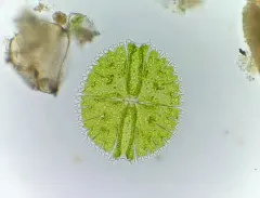 Micrasterias rotata thumbnail 2