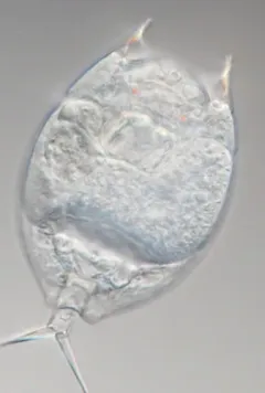 Lepadella patella thumbnail 1